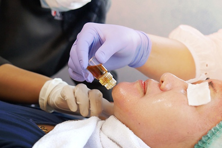 Micro Botox