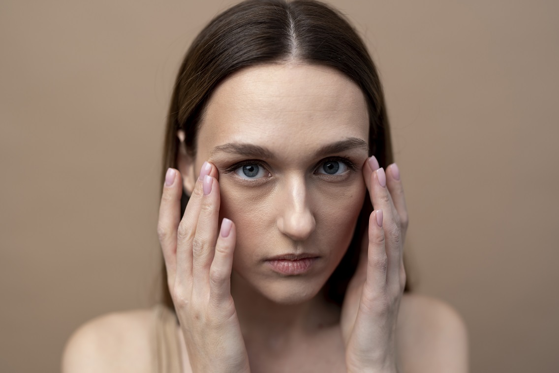 dark circles