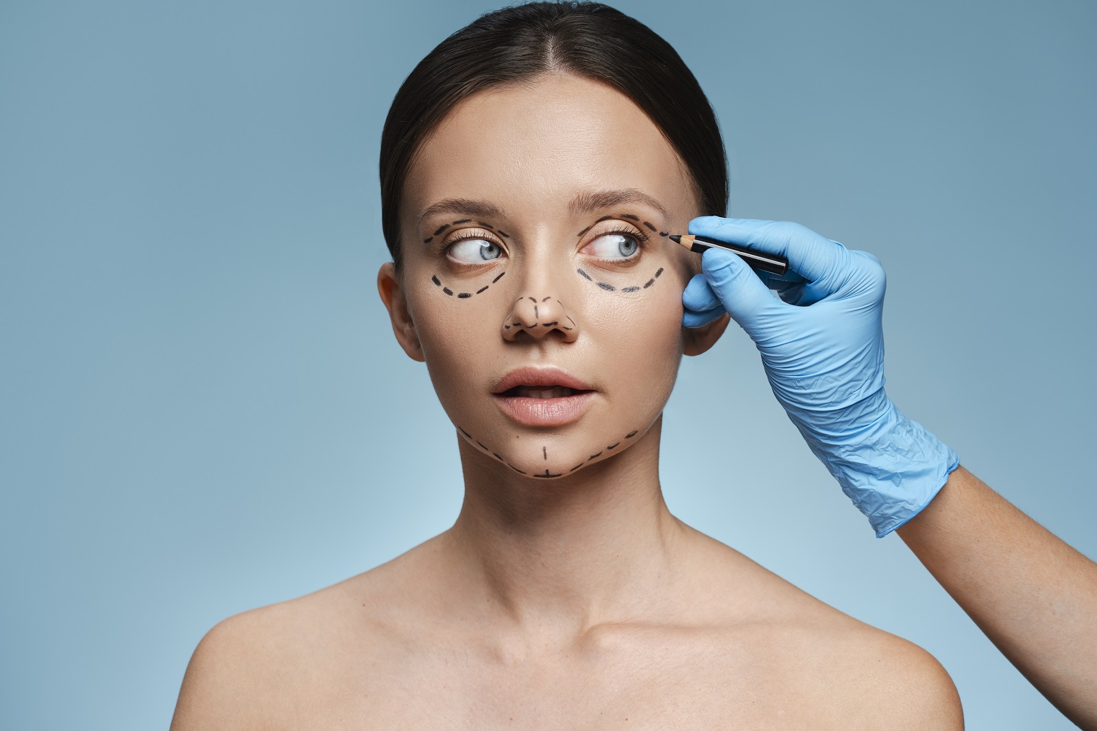 subcision